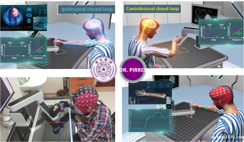 智能精准康复机器人专家系统-