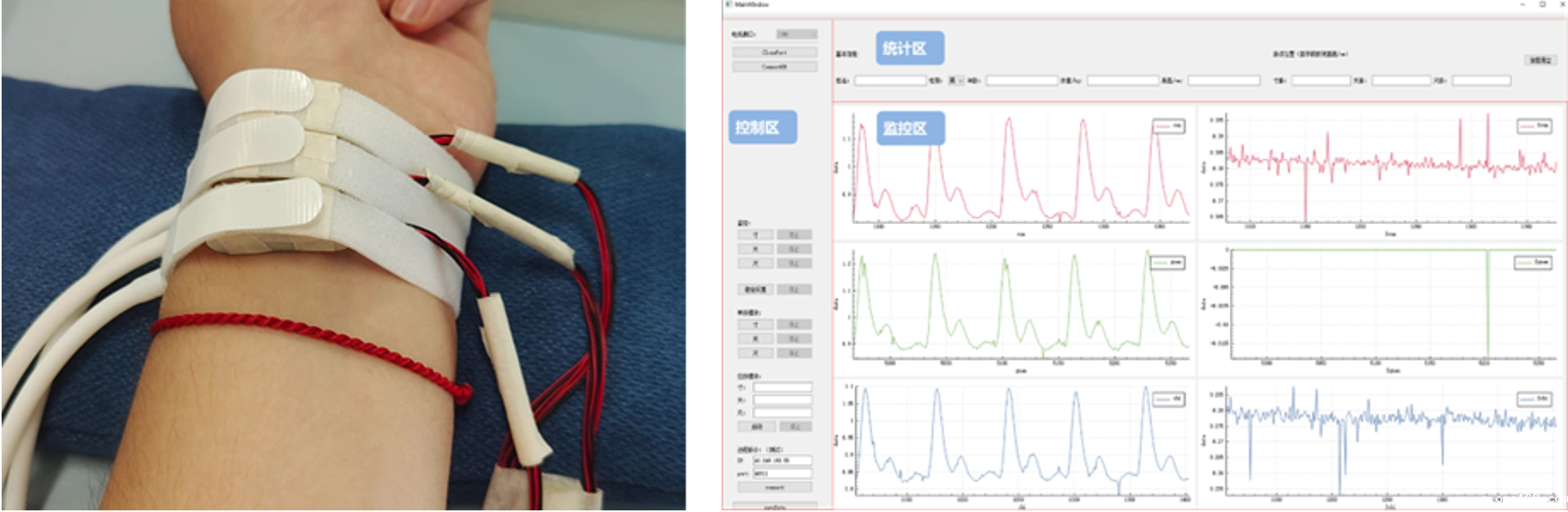 Intelligent Remote TCM Pulse Palpation Device
