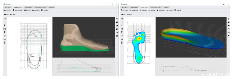 矫形鞋垫快速设计软件-